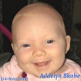 Addelyn Skube